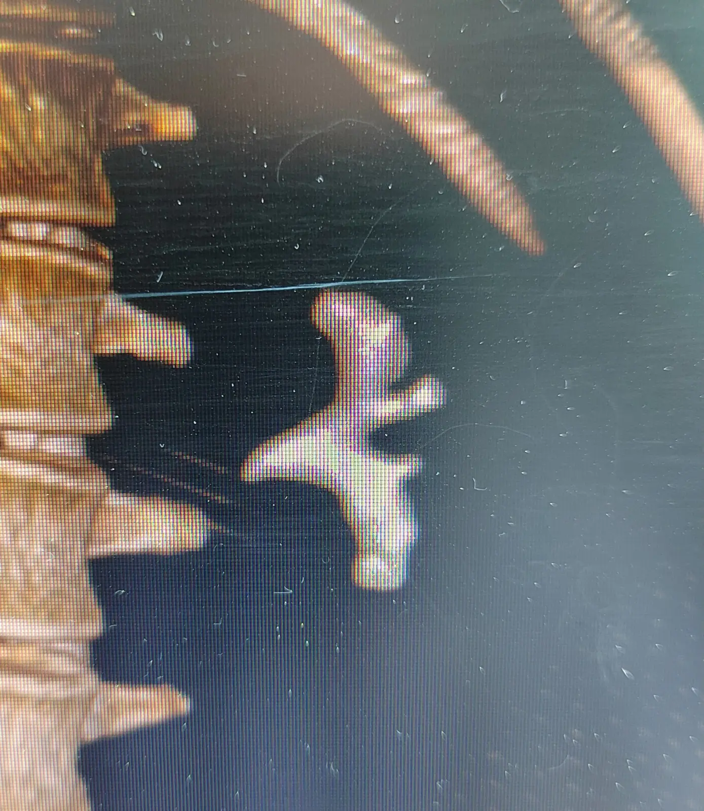 Three-dimensional CT reconstruction showing a staghorn kidney stone