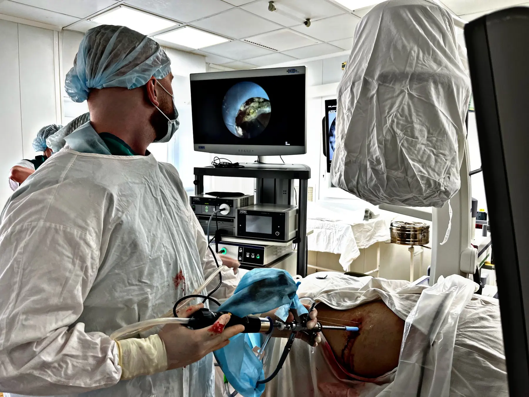 Artem Ershov performing a percutaneous kidney procedure under endoscopic and X-ray control