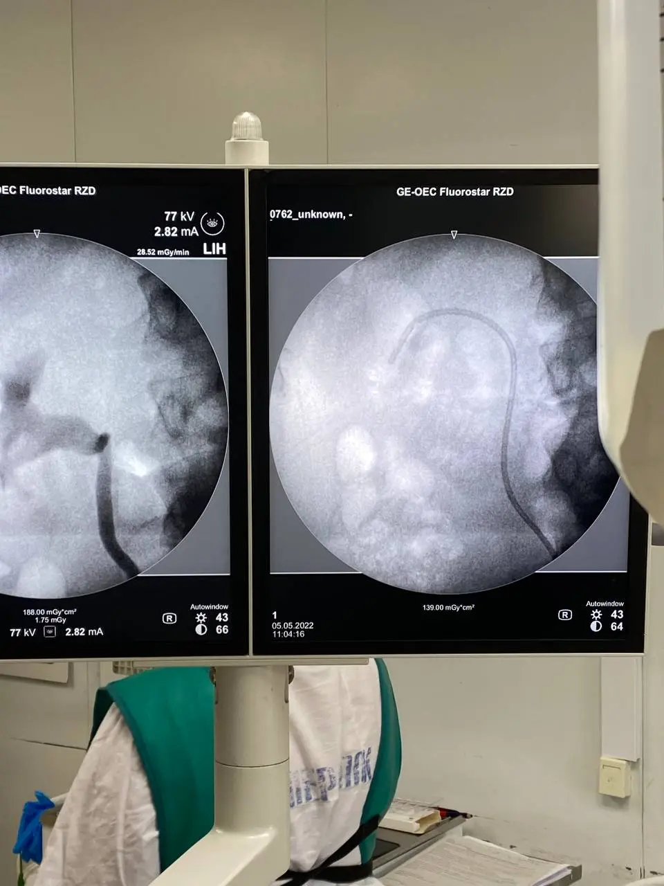 X-ray-guided instrument positioning during RIRS