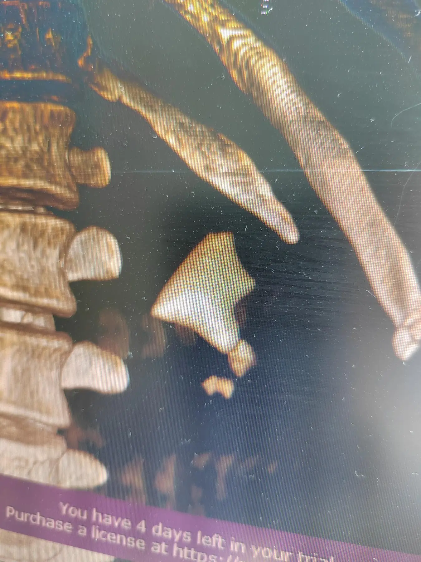 Three-dimensional CT reconstruction showing a complete staghorn kidney stone